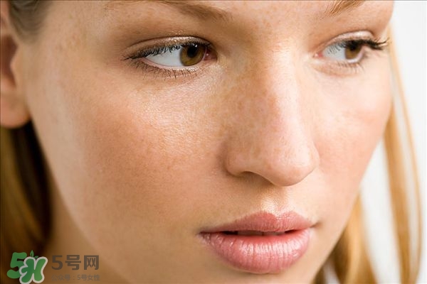 孕斑能用什么方法去除 孕斑怎么去 孕斑能用什么方法去除 孕斑怎么去