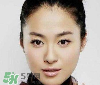 如何預(yù)防臉上長(zhǎng)痣？怎樣預(yù)防臉上長(zhǎng)痣