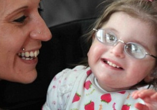 什么是早衰癥？早衰癥初期癥狀