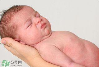 寶寶頭皮上的污垢可以摳掉嗎？寶寶頭上的頭垢該怎么處理？