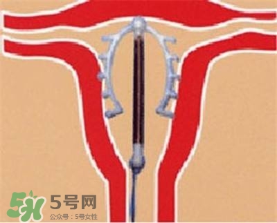 避孕環(huán)安全嗎？避孕環(huán)是什么樣子的圖片