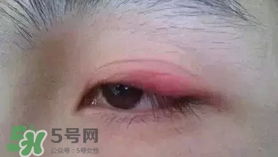 長(zhǎng)期用假睫毛雙眼皮貼對(duì)眼睛有什么傷害？