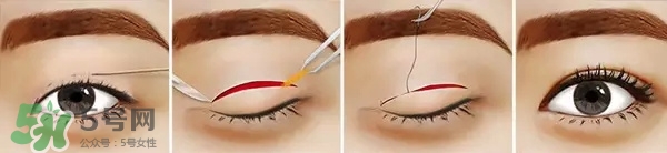 長(zhǎng)期用假睫毛雙眼皮貼對(duì)眼睛有什么傷害？
