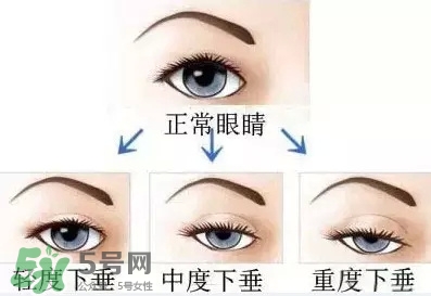 長(zhǎng)期用假睫毛雙眼皮貼對(duì)眼睛有什么傷害？