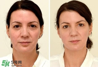 30天不喝飲料，妹子的對(duì)比照令人震驚 喝白開(kāi)水的好處