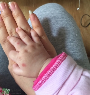 日本叮叮對(duì)寶寶有害嗎？日本叮叮驅(qū)蚊劑孕婦可以用嗎