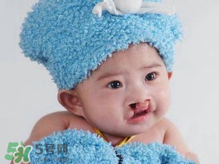 兔唇可以治嗎？兔唇修補(bǔ)術(shù)