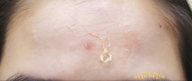 real skin patch怎么樣？real skin是什么牌子