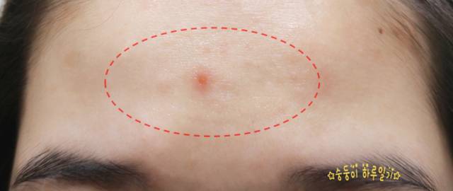 real skin patch怎么樣？real skin是什么牌子