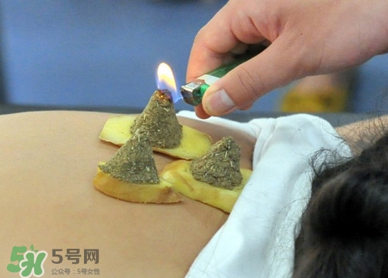 三伏灸灸哪里？三伏灸是每天都灸嗎