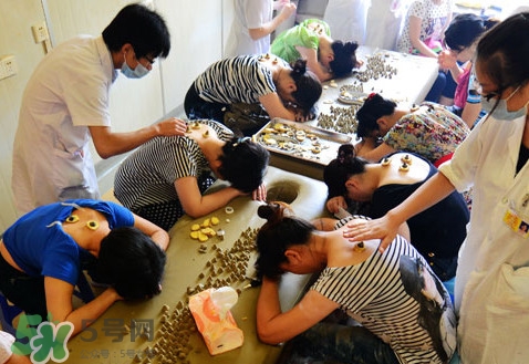 三伏灸有什么作用？三伏灸不能吃什么