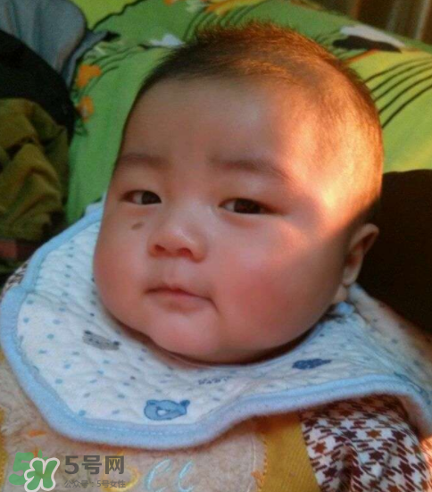 寶寶胎記什么時(shí)候去掉？寶寶胎記什么時(shí)候去掉最好？