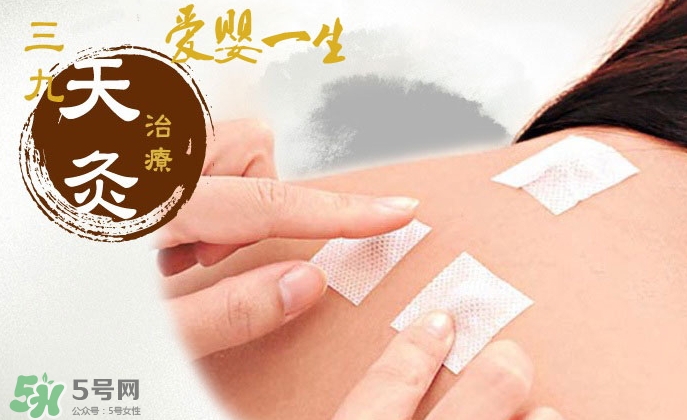 貼三伏貼掛什么科？三伏貼掛什么號？