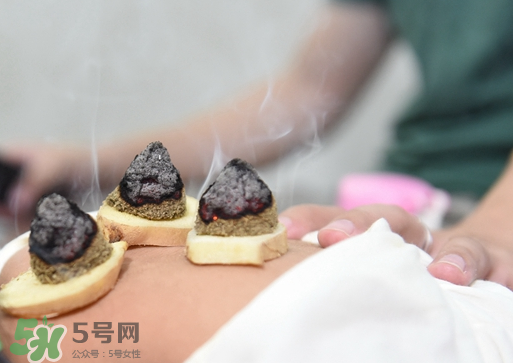 三伏灸什么人不能做？三伏灸適合哪些人？