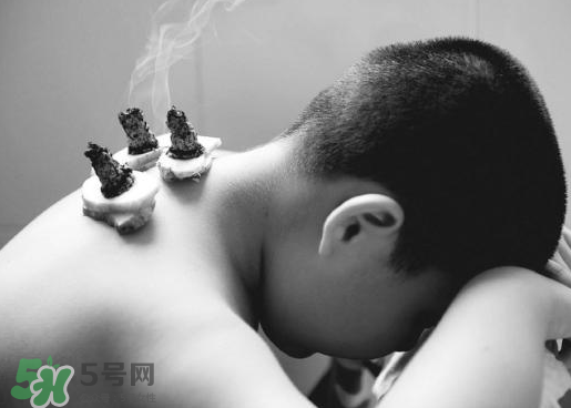 三伏灸什么人不能做？三伏灸適合哪些人？