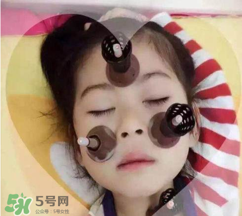 艾灸貼可以治咳嗽嗎？艾灸貼可以治退燒嗎？