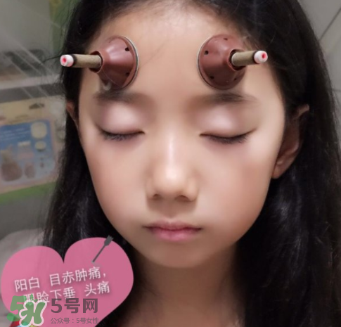 艾灸貼可以治咳嗽嗎？艾灸貼可以治退燒嗎？