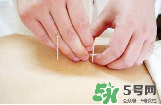 什么人不能做放血療法？放血療法有什么功效？