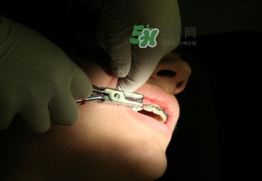 三伏天可以拔牙嗎嗎?三伏天拔牙好嗎？