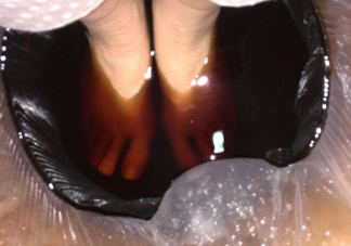 醋泡腳用白醋還是陳醋？泡腳用什么醋最好？