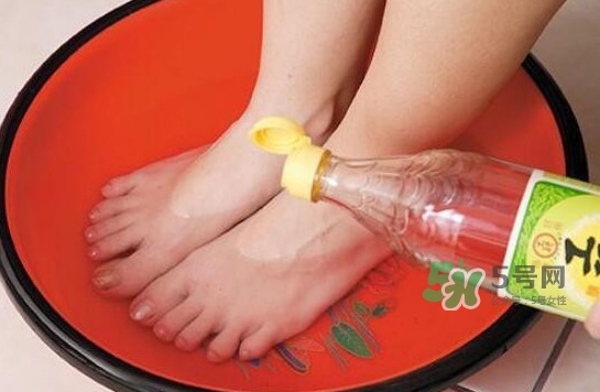 醋泡腳用白醋還是陳醋？泡腳用什么醋最好？