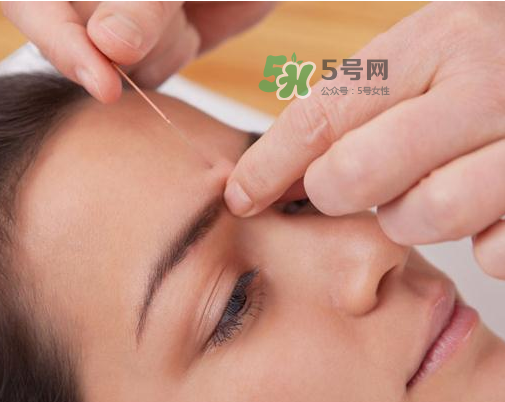 三伏天針灸有什么好處？三伏天針灸注意什么？