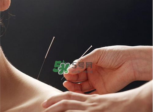 三伏天針灸有什么好處？三伏天針灸注意什么？