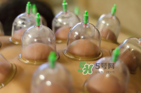 拔火罐是夏天好還是冬天好？什么時(shí)候拔火罐最合適？