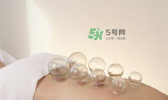 拔火罐是夏天好還是冬天好？什么時(shí)候拔火罐最合適？