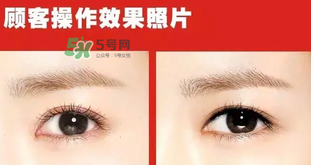 美瞳線有必要做嗎？做美瞳線多少錢？