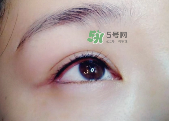 做美瞳線疼嗎？做美瞳線后要注意什么？