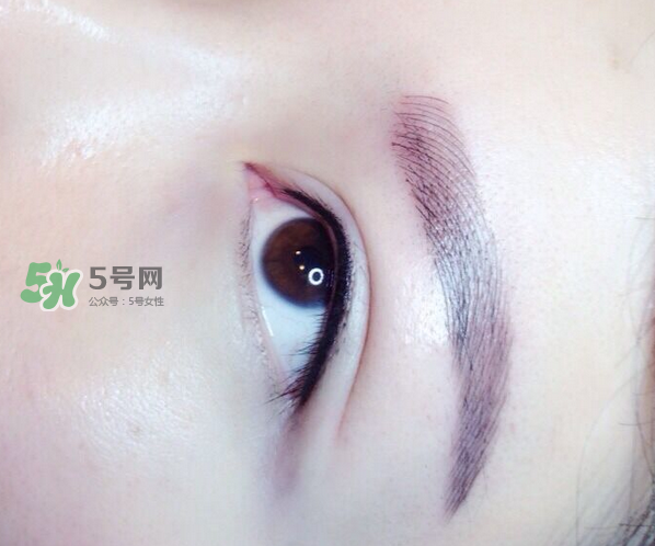 做美瞳線疼嗎？做美瞳線后要注意什么？