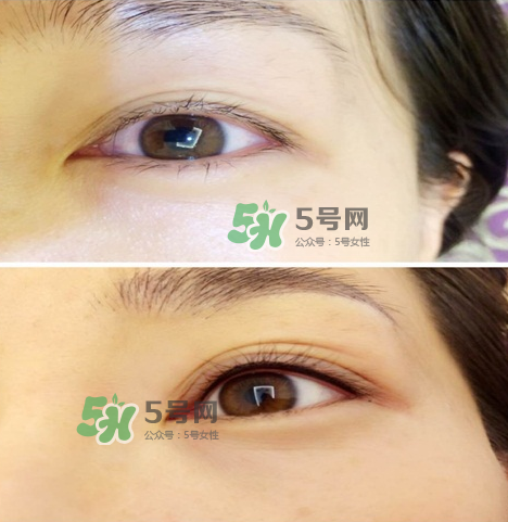 做美瞳線眼睛會腫嗎?做美瞳線眼睛腫了怎么辦? 做美瞳線眼睛會腫嗎?做美瞳線眼睛腫了怎么辦?