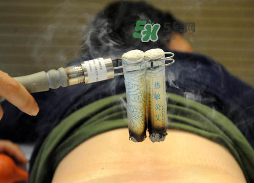 三伏天艾灸后能吹空調(diào)嗎？三伏天艾灸后能吹電扇嗎？