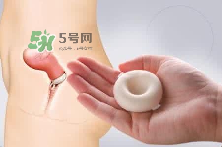 殺精劑有什么副作用？殺精劑的使用方法