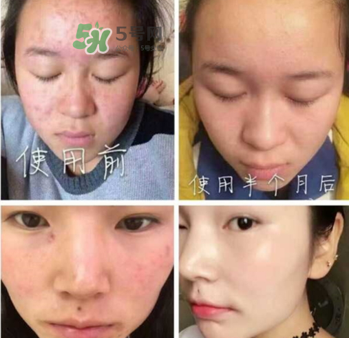 神仙膏貴婦膏是真是假_有激素嗎_什么功效價(jià)格 神仙膏貴婦膏是真是假_有激素嗎_什么功效價(jià)格