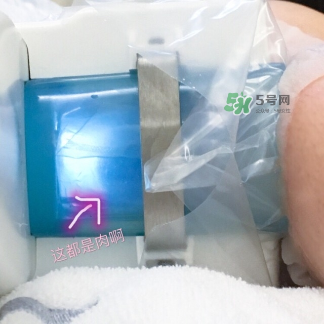 酷塑溶脂效果對(duì)比圖片 酷塑溶脂全過(guò)程記錄 酷塑溶脂效果對(duì)比圖片 酷塑溶脂全過(guò)程記錄