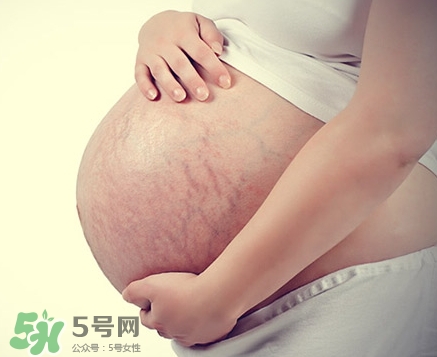 孕婦胸部長妊娠紋嗎？胸部長妊娠紋了怎么辦？