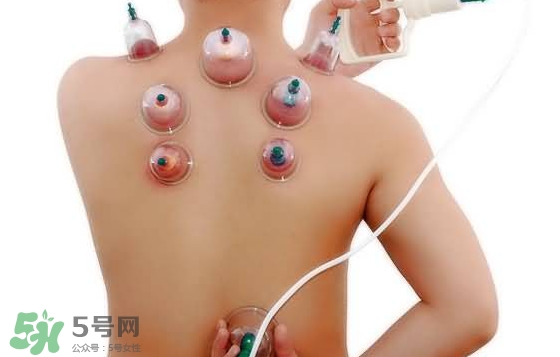 火罐和真空罐哪個好？真空罐和火罐效果一樣好嗎