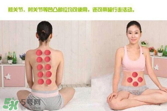 火罐和真空罐哪個好？真空罐和火罐效果一樣好嗎