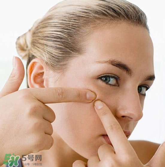 長痘長閉口怎么辦？長痘長閉口是什么原因？