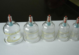 真空拔罐拔出水泡來是怎么回事？真空拔罐的正確使用方法