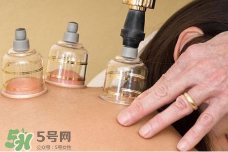 真空拔罐有用嗎？真空拔罐多長時間合適