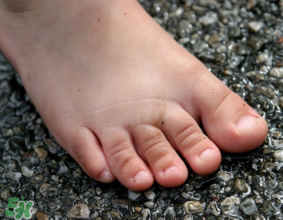 日本灰指甲藥水有用嗎？日本灰指甲藥水評測