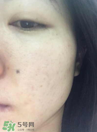 赫蓮娜悅活蓄能新肌水怎么樣 綠寶瓶蓄能新肌水好用嗎 赫蓮娜悅活蓄能新肌水怎么樣 綠寶瓶蓄能新肌水好用嗎