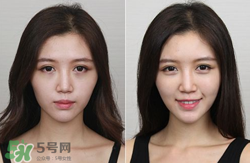 蘋果肌怎么化？蘋果肌究竟哪里好？