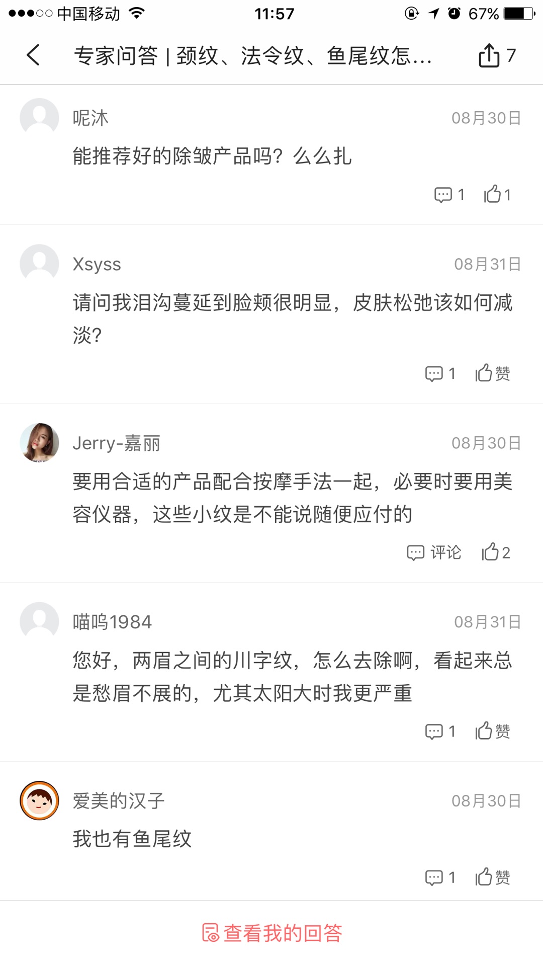 天生的魚尾紋怎么去除或淡化 天生的魚尾紋怎么去除或淡化