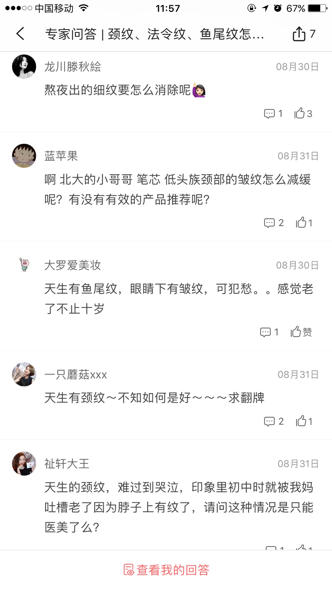 天生的魚尾紋怎么去除或淡化 天生的魚尾紋怎么去除或淡化