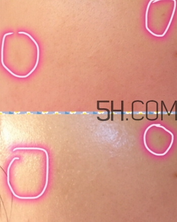 嬌韻詩黃金雙瓶真假 嬌韻詩黃金雙瓶真假辨別 嬌韻詩黃金雙瓶真假 嬌韻詩黃金雙瓶真假辨別