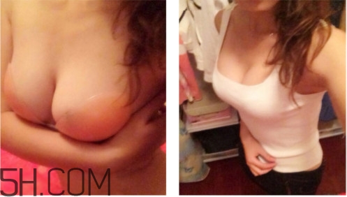 胸貼買哪種比較好 胸貼哪種材質(zhì)的好 胸貼買哪種比較好 胸貼哪種材質(zhì)的好